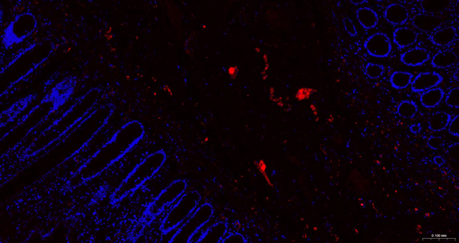 神经细胞胞浆蛋白9.5重组兔单抗
