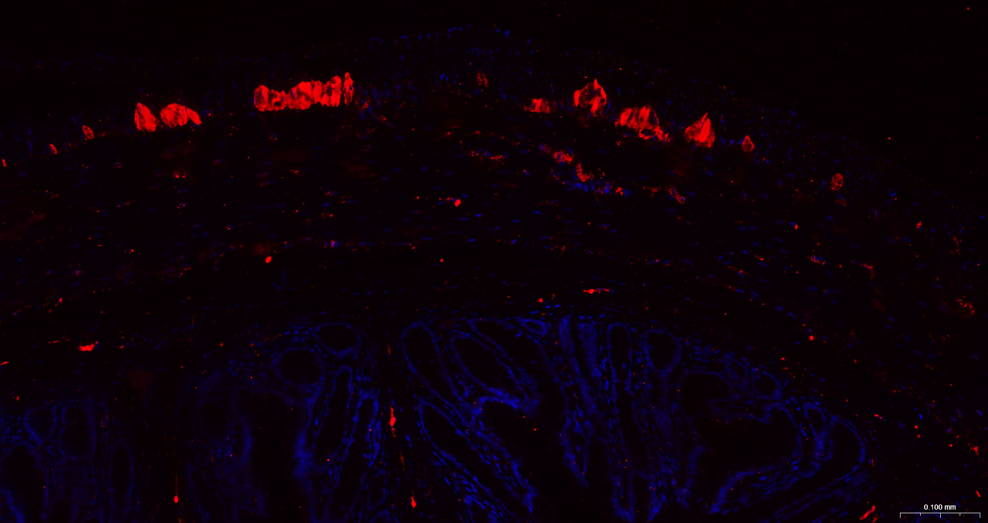 神经细胞胞浆蛋白9.5重组兔单抗