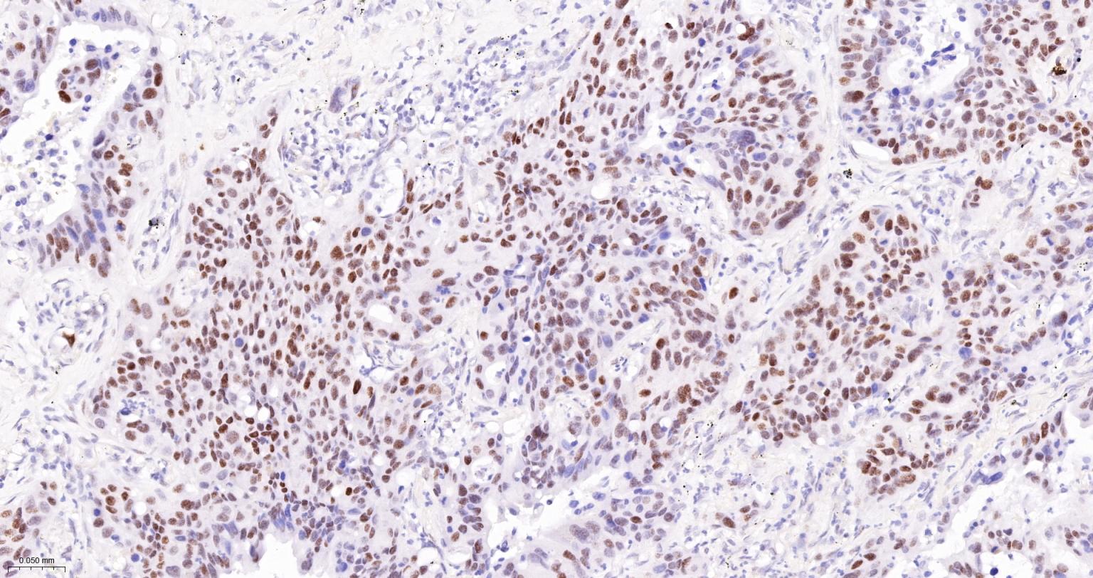错配修复蛋白6重组兔单抗