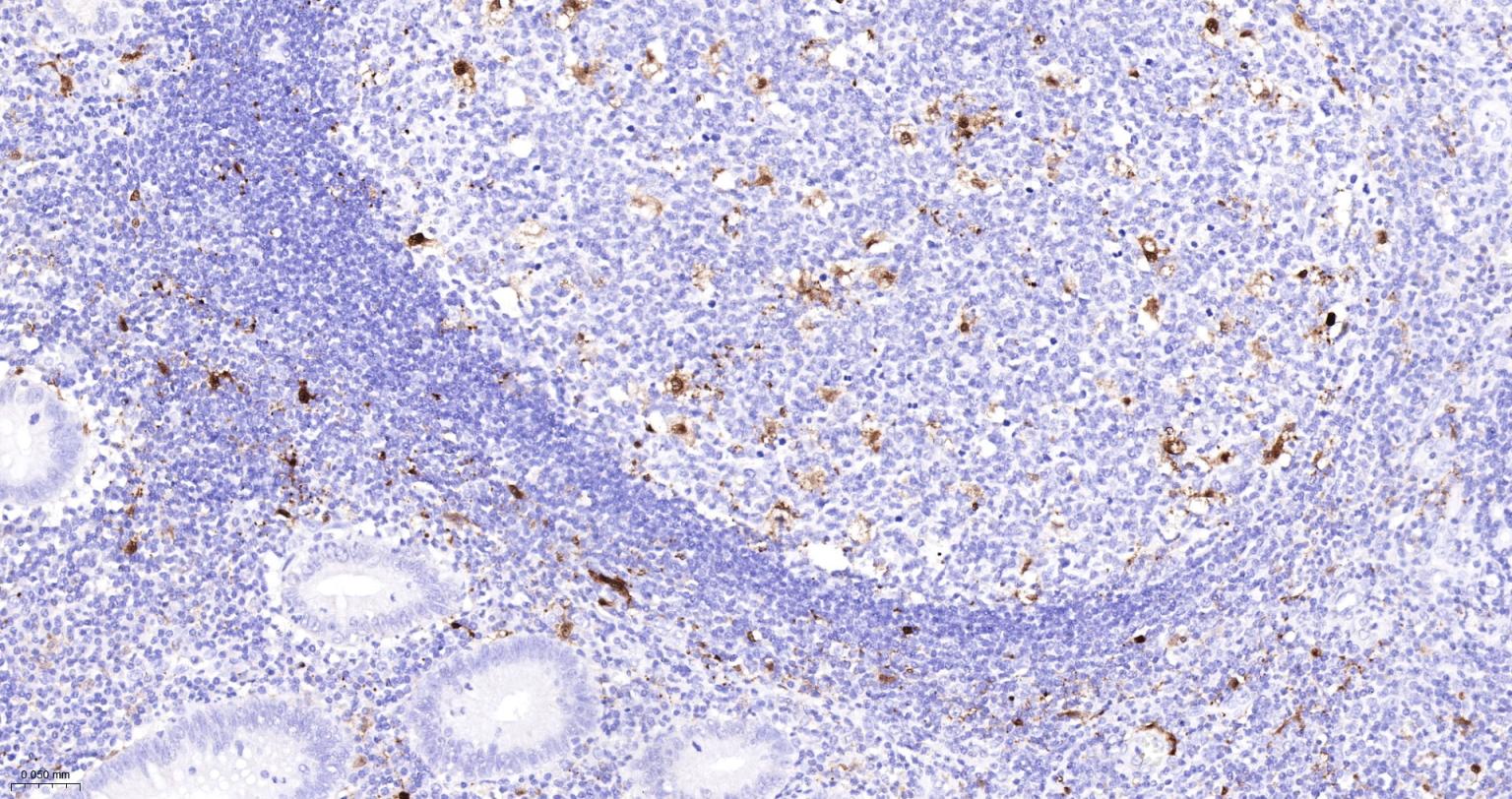 白细胞介素-18/干扰素γ诱导因子重组兔单抗