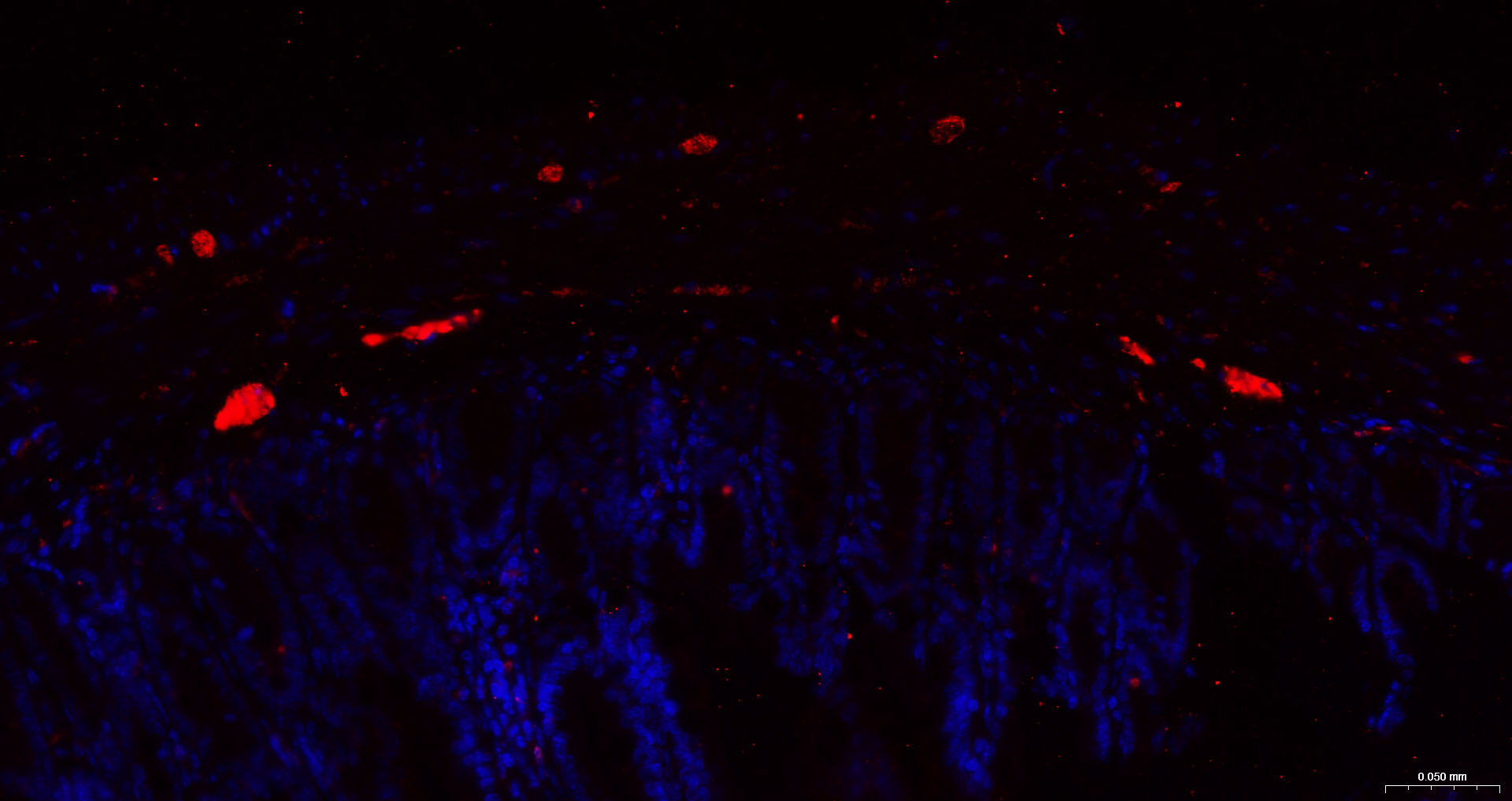 神经细胞胞浆蛋白9.5重组兔单抗