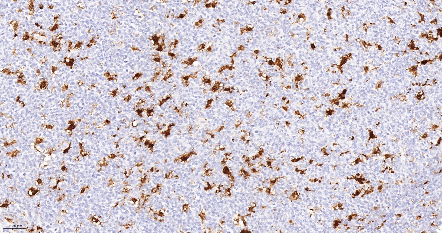 白细胞介素-18/干扰素γ诱导因子重组兔单抗