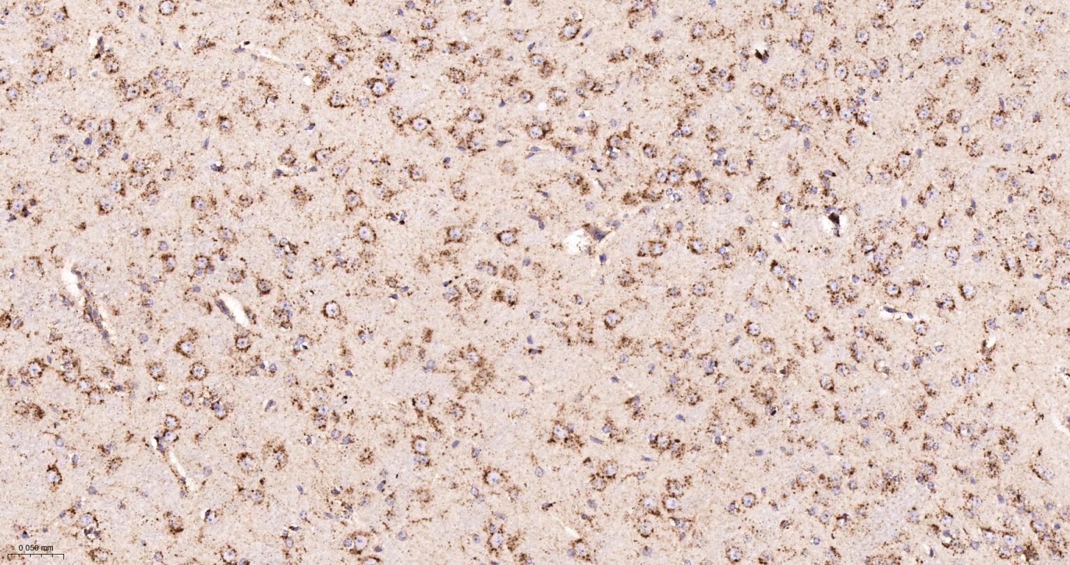 清道夫受体B2重组兔单抗