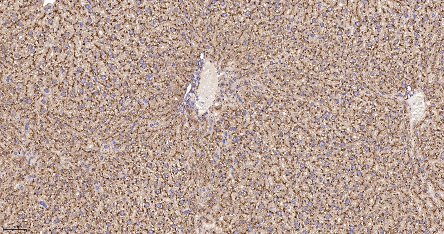 清道夫受体B2重组兔单抗