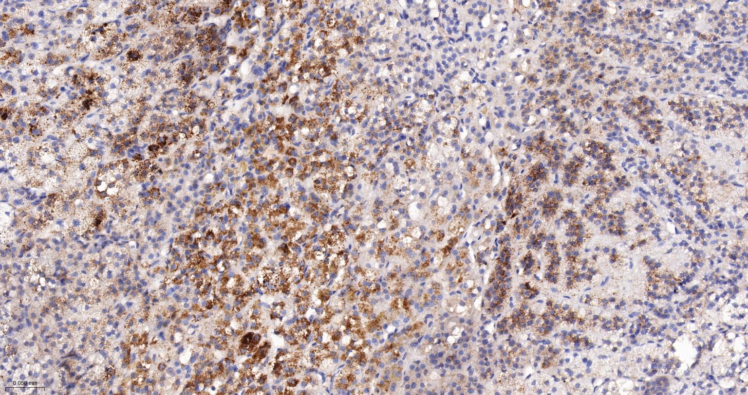 α-半乳糖苷酶重组兔单抗