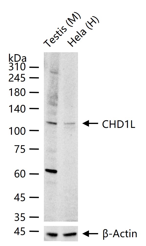 染色质解旋酶DNA结合蛋白重组兔单抗
