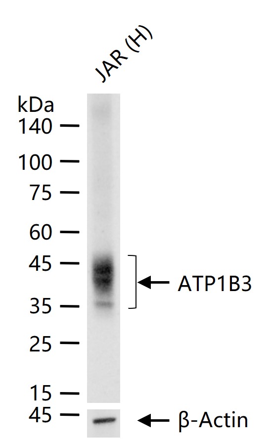 钠/钾转运 ATP 酶亚基 beta-3重组兔单抗