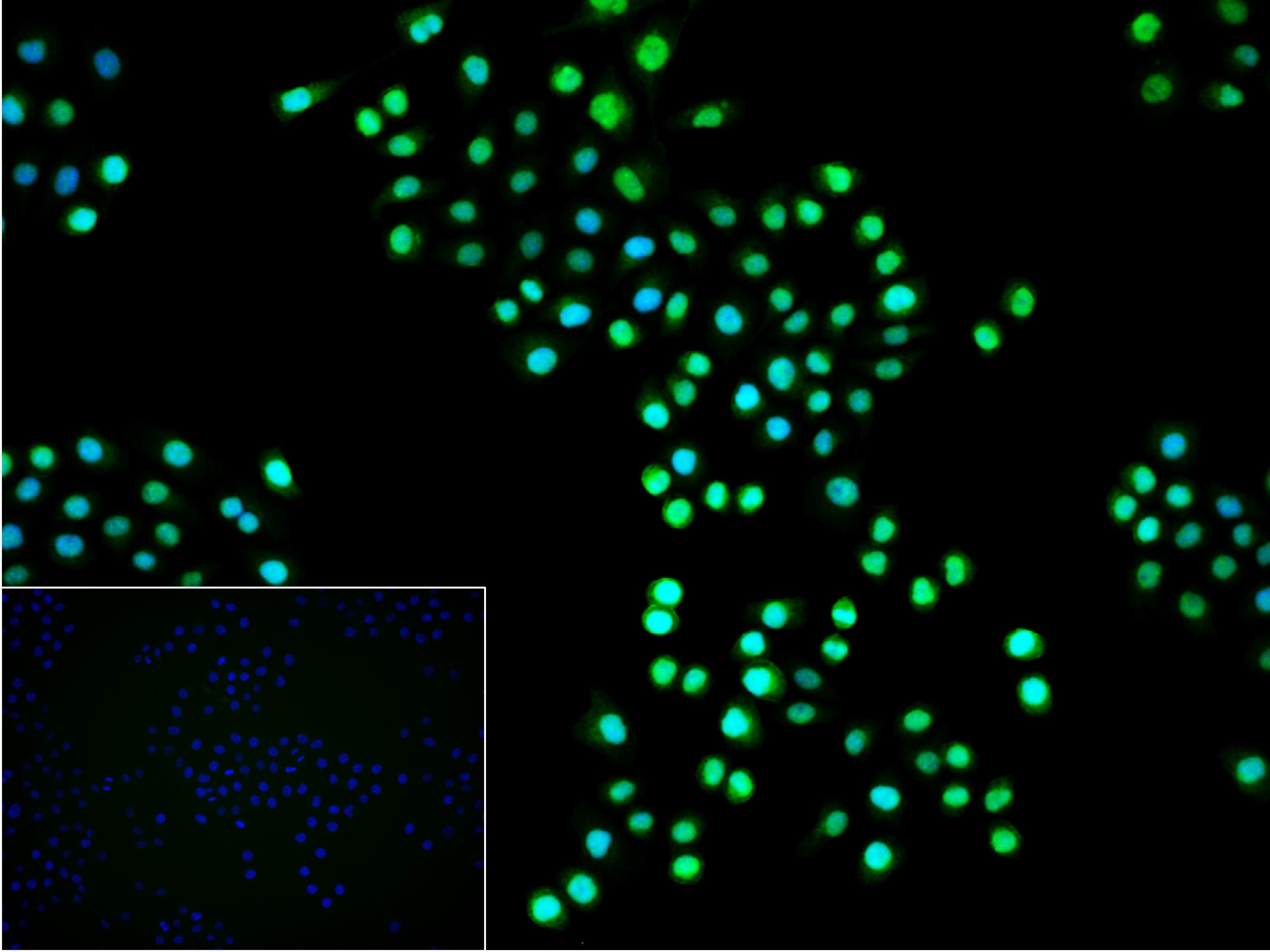 Rad51重组兔单抗