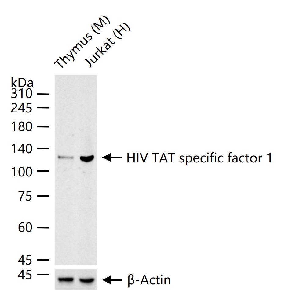 艾滋病病毒特殊因子1重组兔单抗