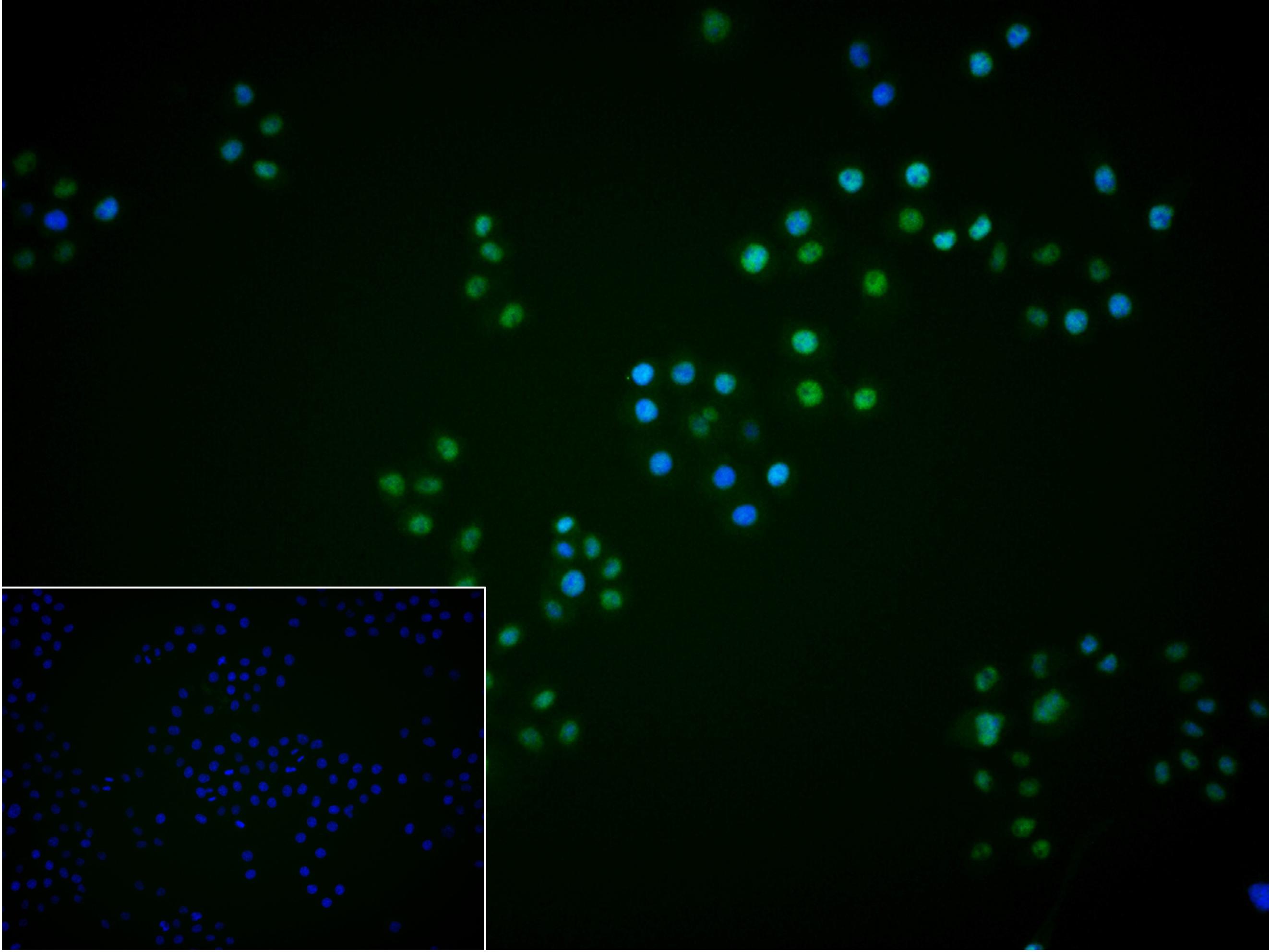 原癌基因Yes相关蛋白1重组兔单抗