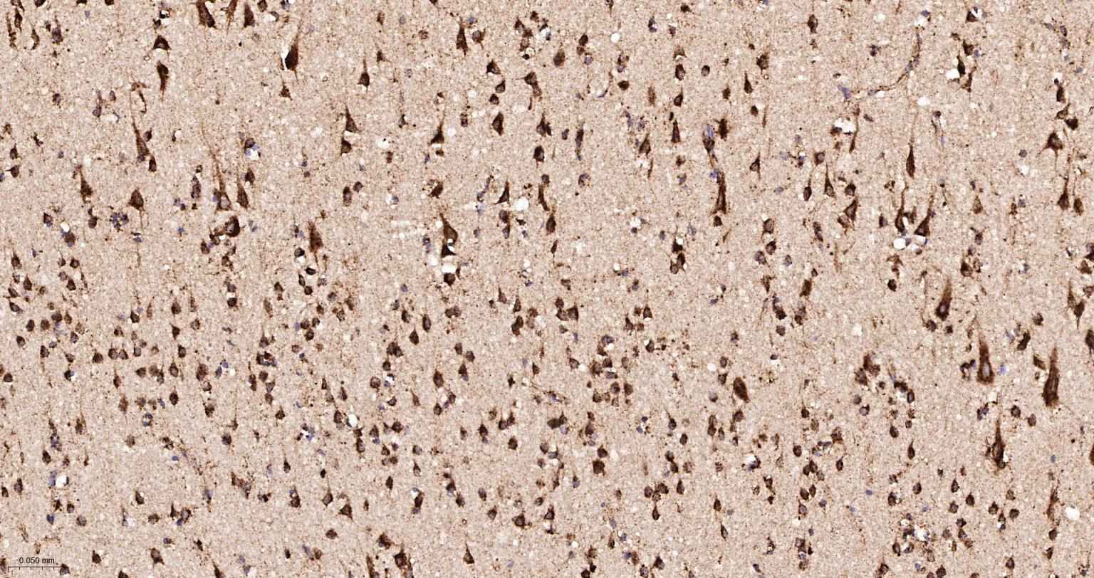 清道夫受体B2重组兔单抗