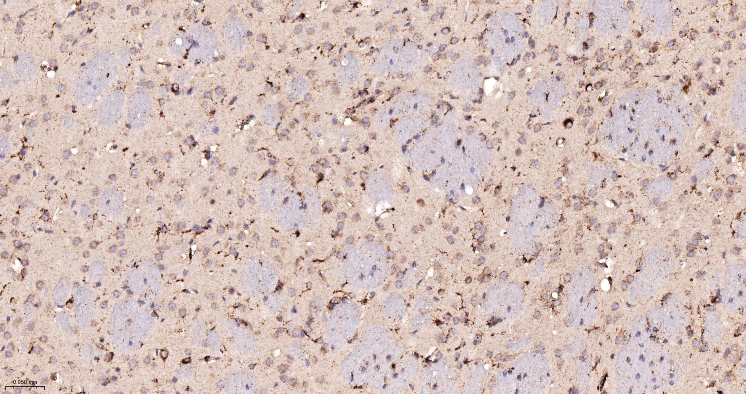 清道夫受体B2重组兔单抗