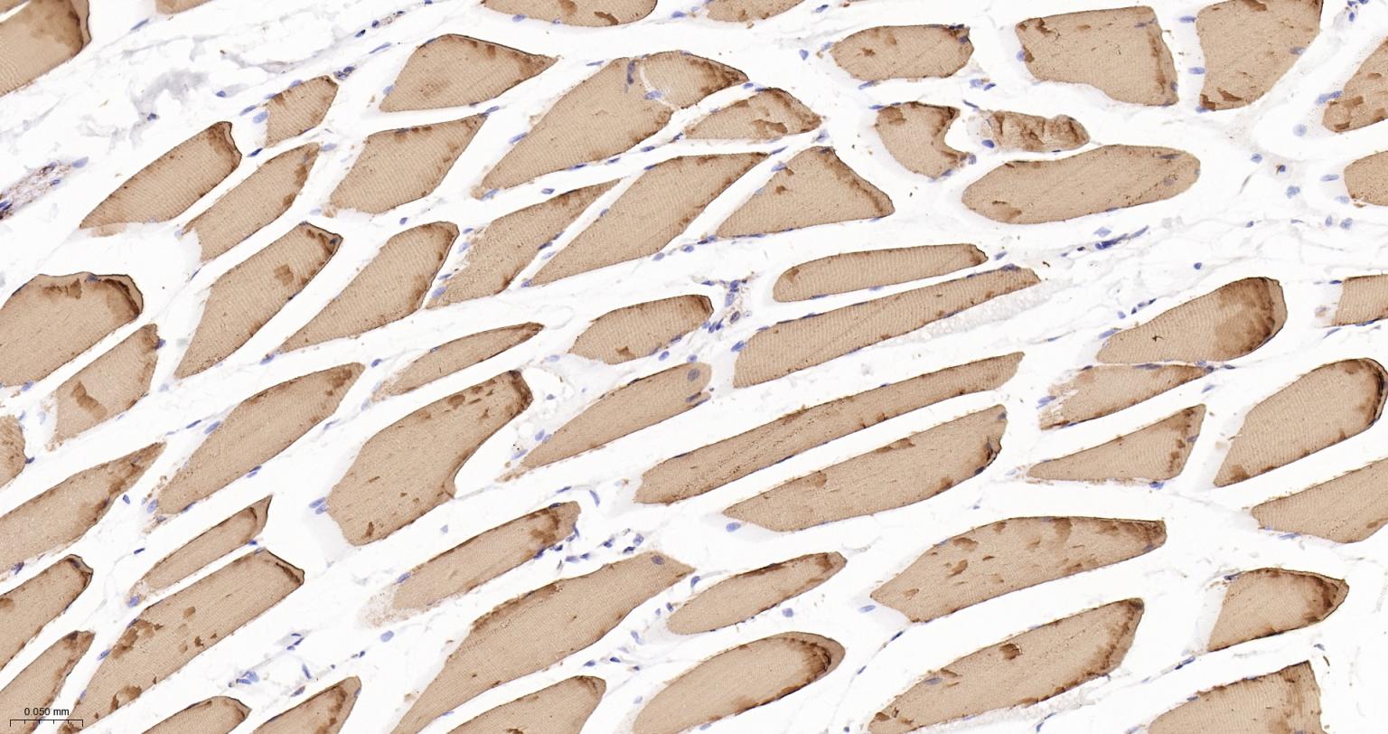 原肌球蛋白1重组兔单抗