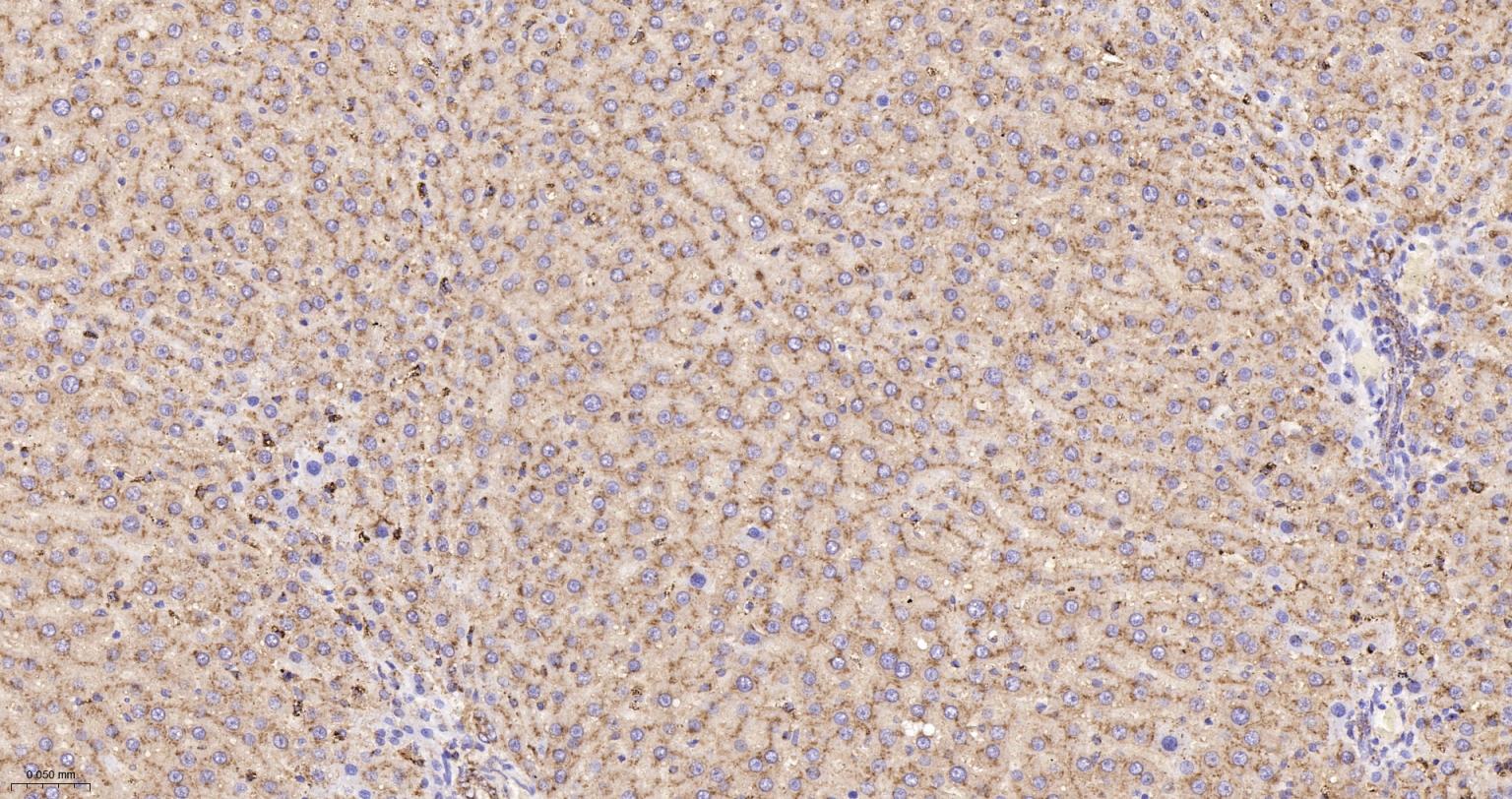 清道夫受体B2重组兔单抗