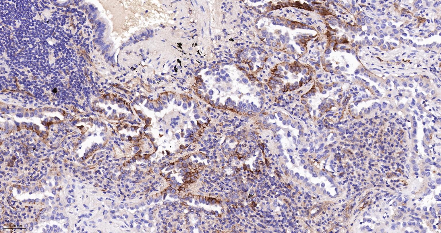 分化相关基因NDRG1重组兔单抗