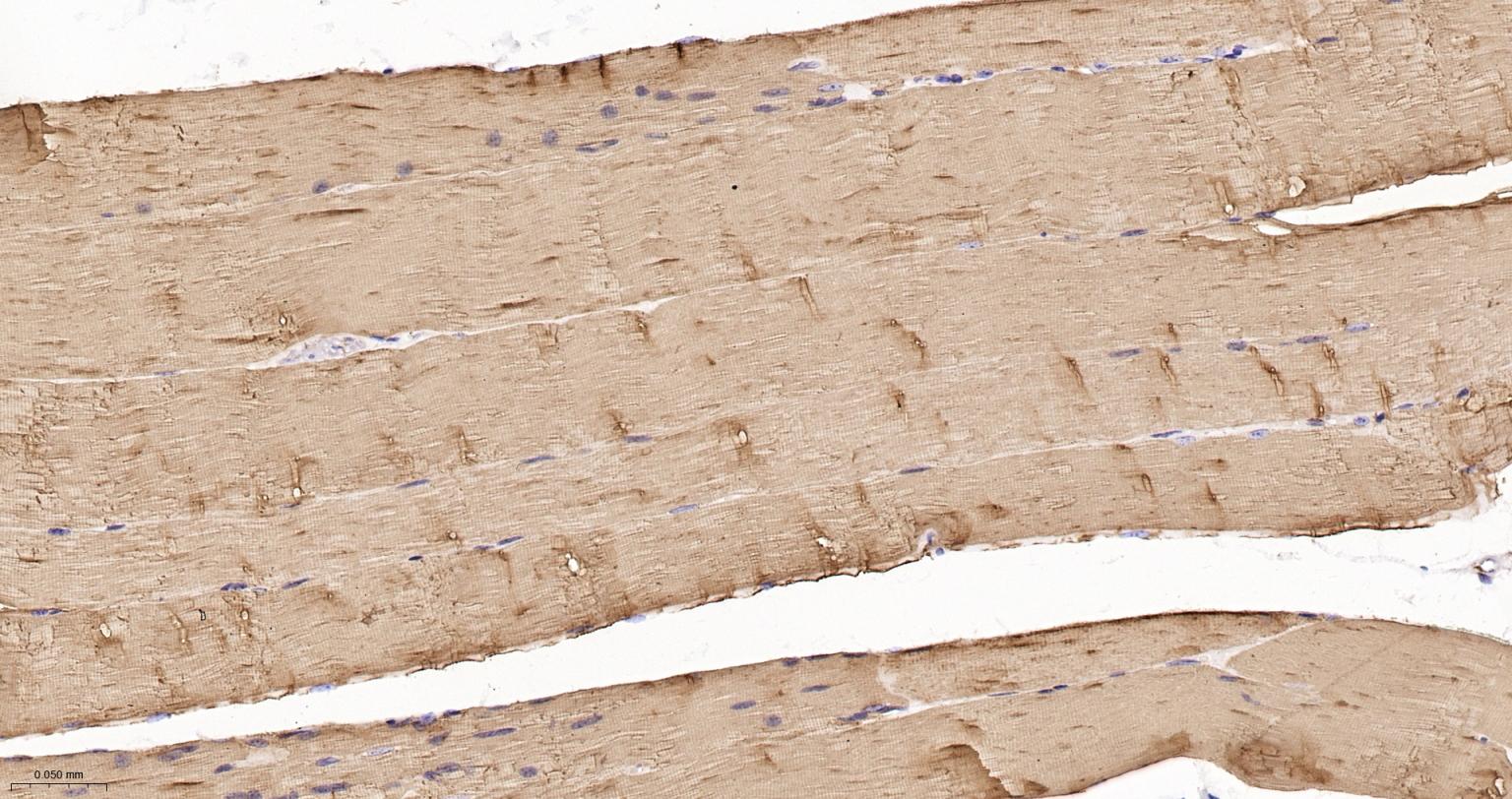 原肌球蛋白1重组兔单抗