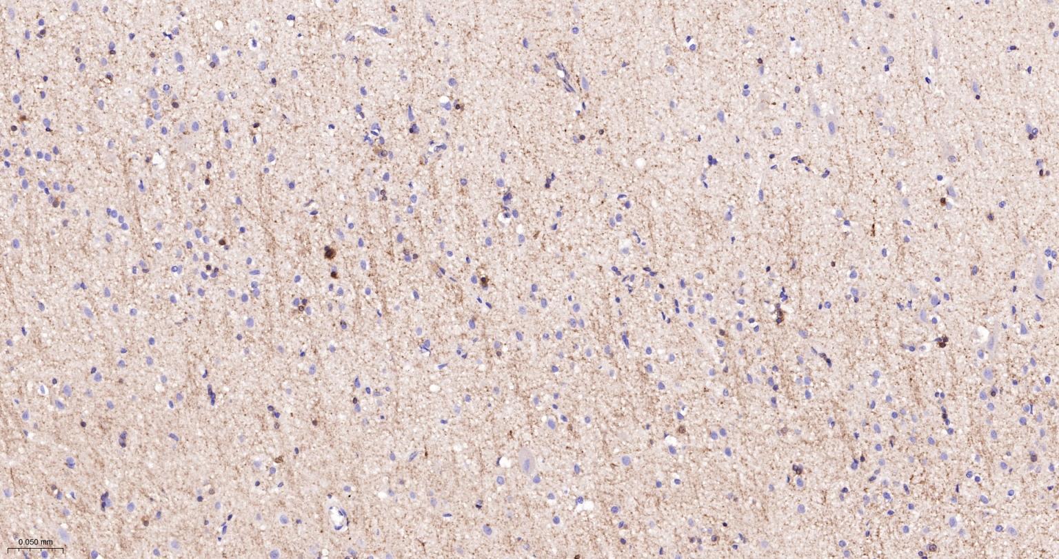 分化相关基因NDRG1重组兔单抗