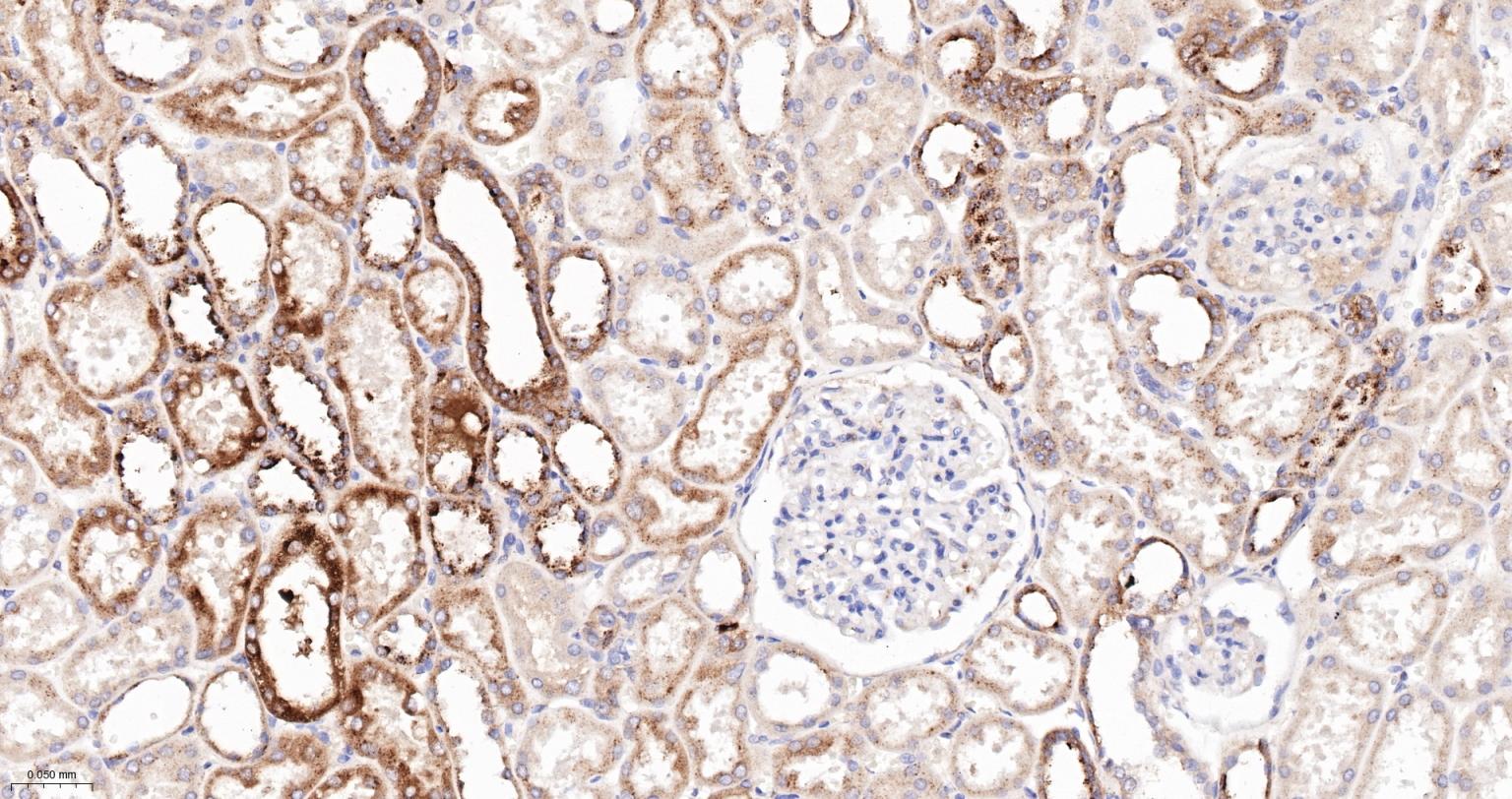 α-半乳糖苷酶重组兔单抗