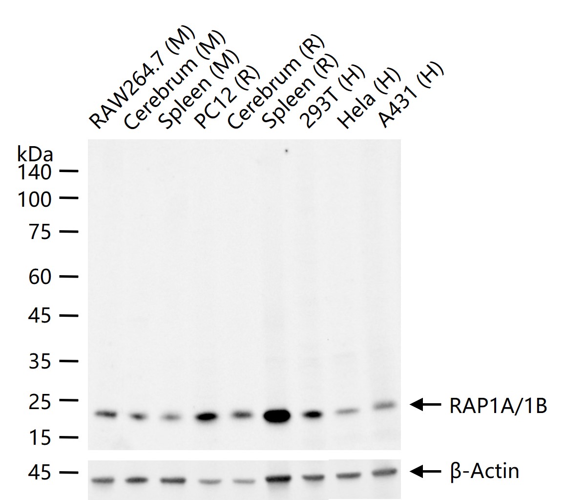 RAP1A/1B重组兔单抗