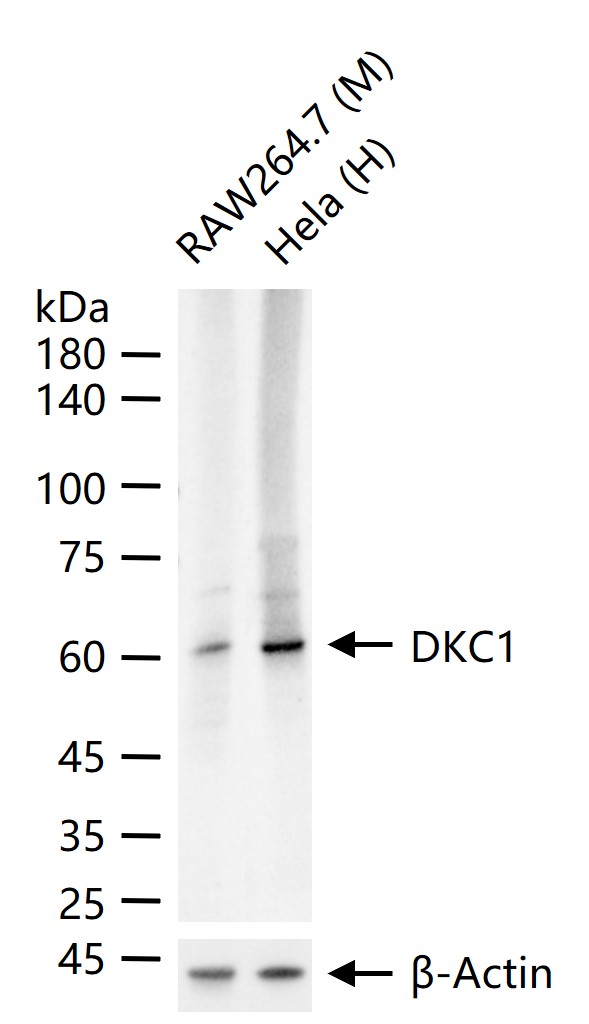 DKC1 Recombinant Rabbit mAb (一抗) - WB,IHC-P,IHC-F,IF,Flow-Cyt,ICC/IF | Bioss