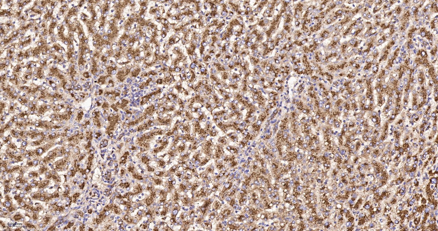 清道夫受体B2重组兔单抗