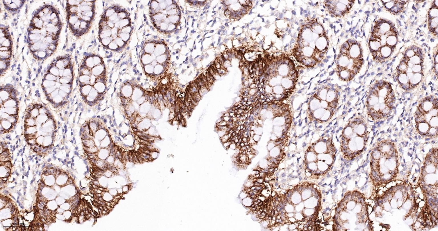 分化相关基因NDRG1重组兔单抗