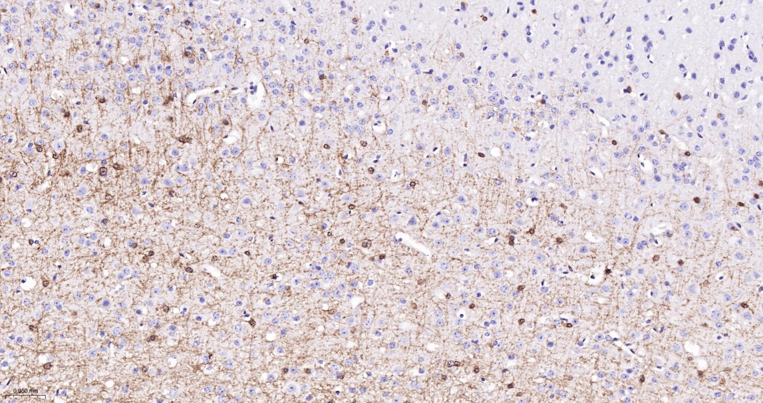 分化相关基因NDRG1重组兔单抗