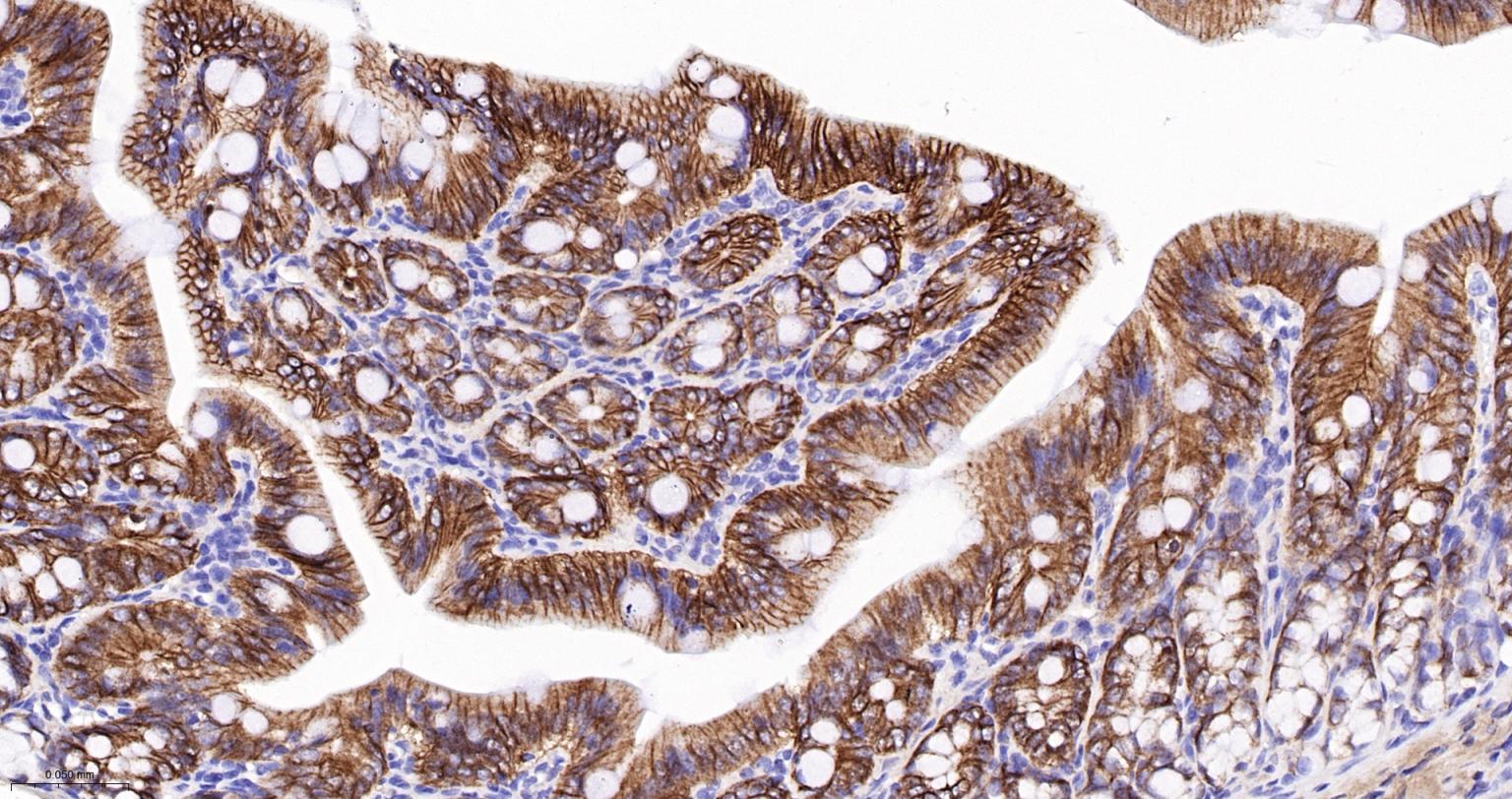 分化相关基因NDRG1重组兔单抗