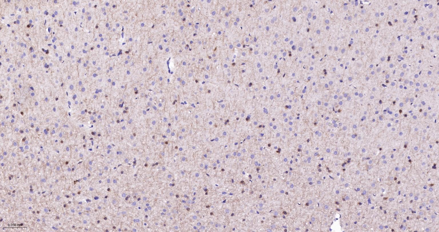 分化相关基因NDRG1重组兔单抗