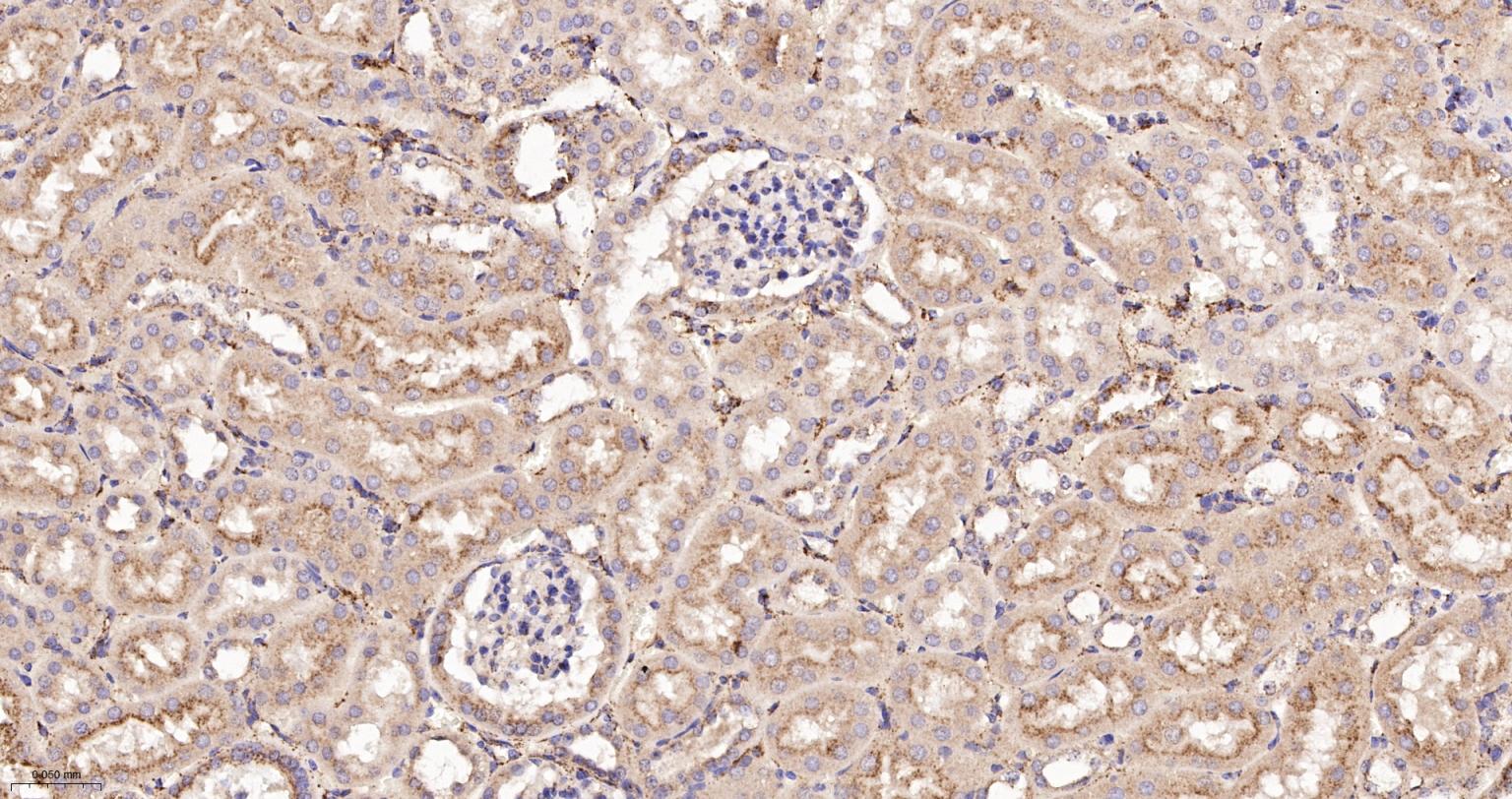 清道夫受体B2重组兔单抗