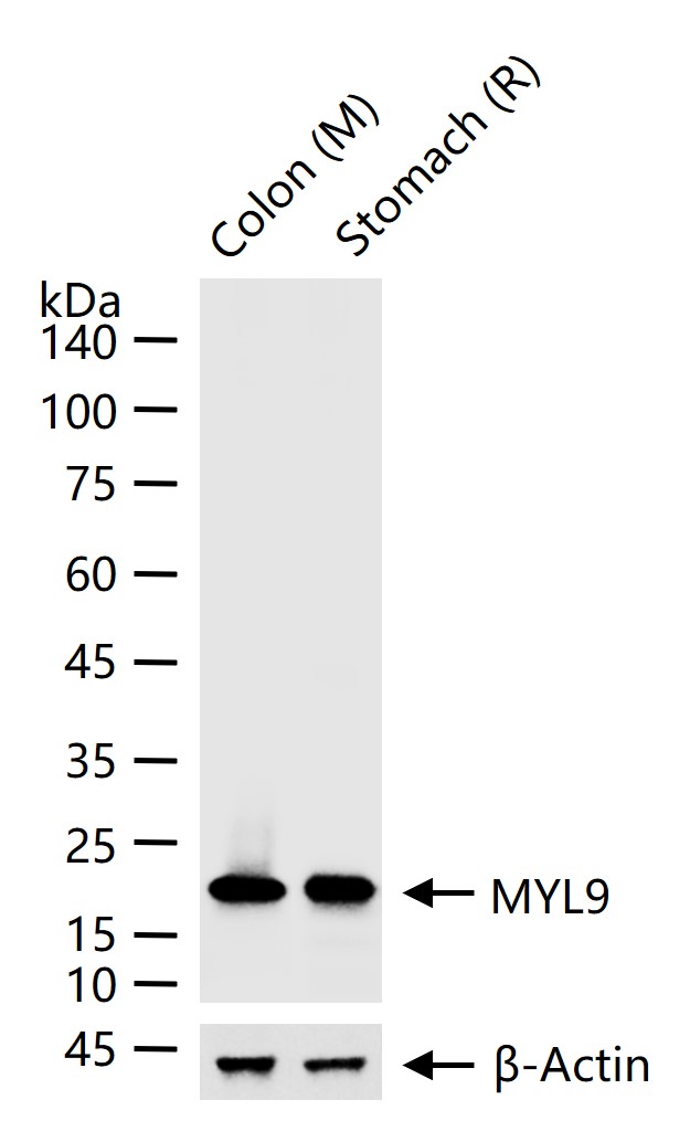 肌球蛋白调节多肽9重组兔单抗