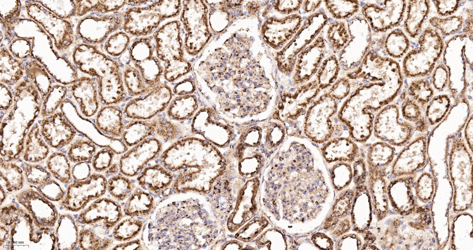 清道夫受体B2重组兔单抗