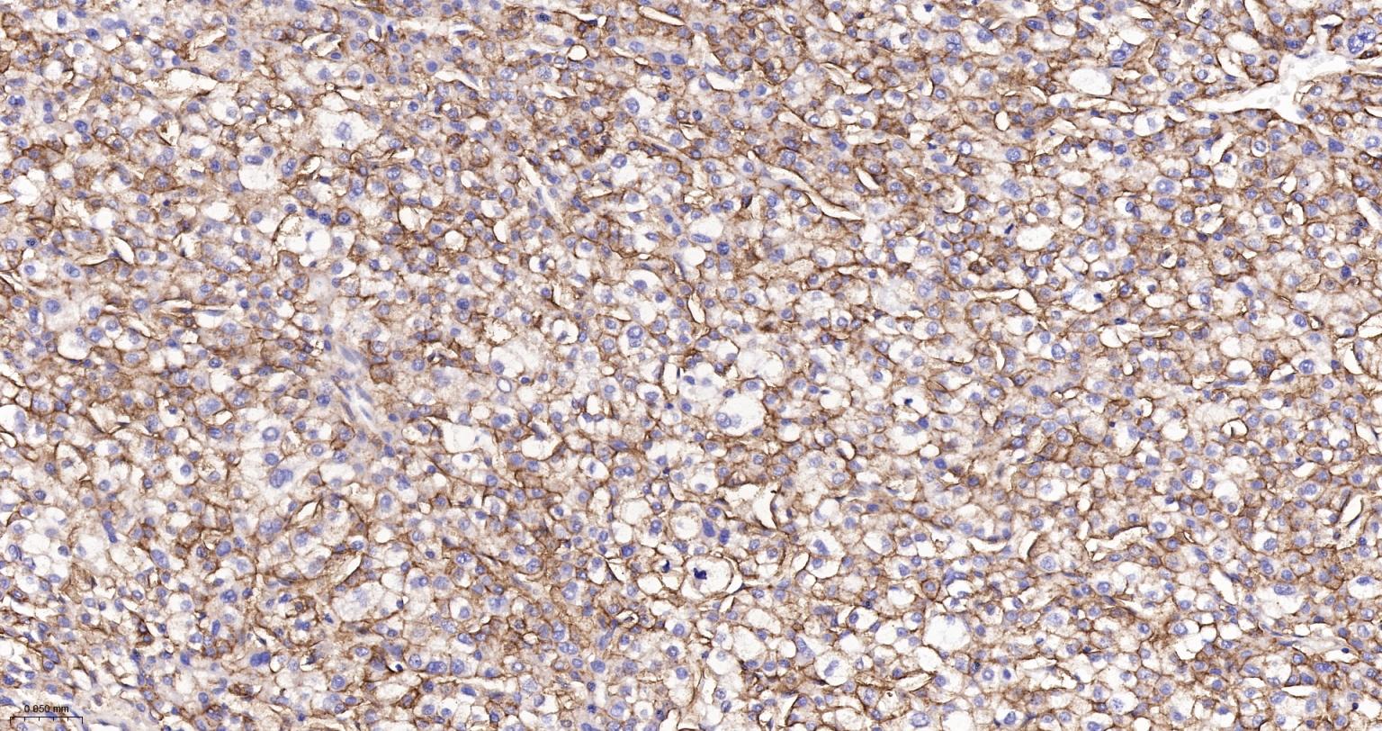 分化相关基因NDRG1重组兔单抗