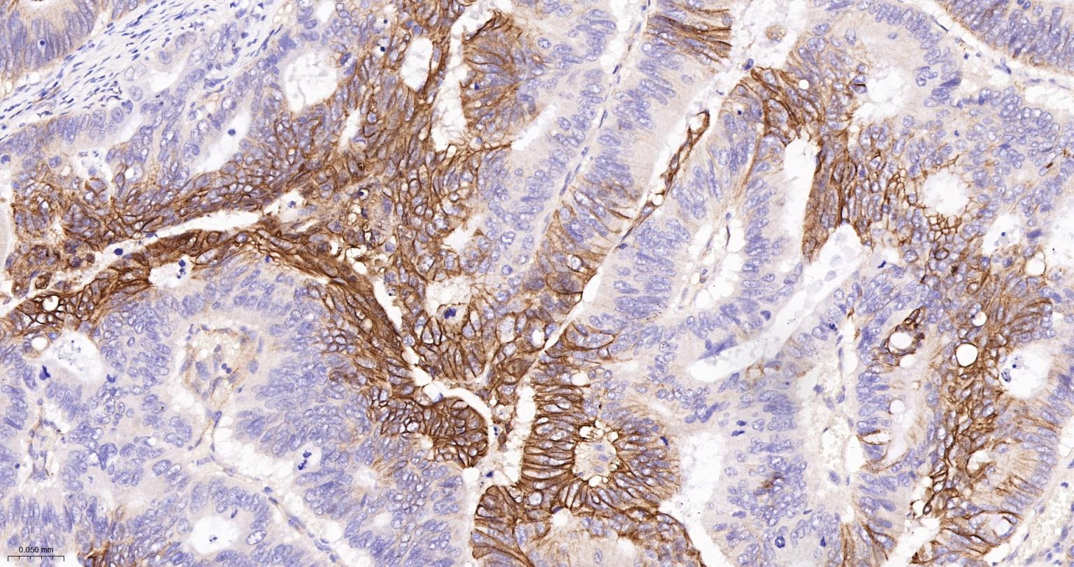 分化相关基因NDRG1重组兔单抗