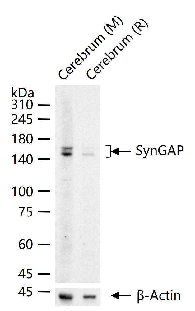 认知缺陷突触相关蛋白SynGAP重组兔单抗