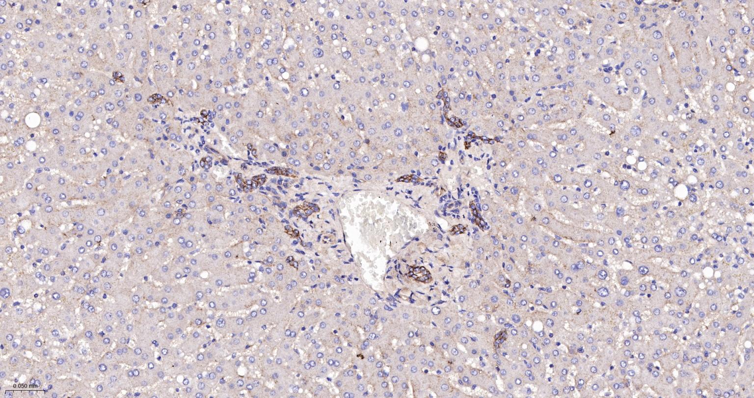 分化相关基因NDRG1重组兔单抗
