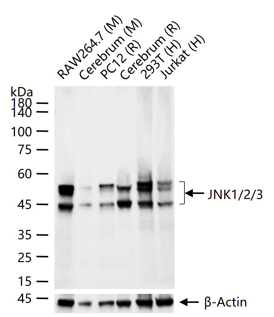 氨基末端激酶1/2/3重组兔单抗