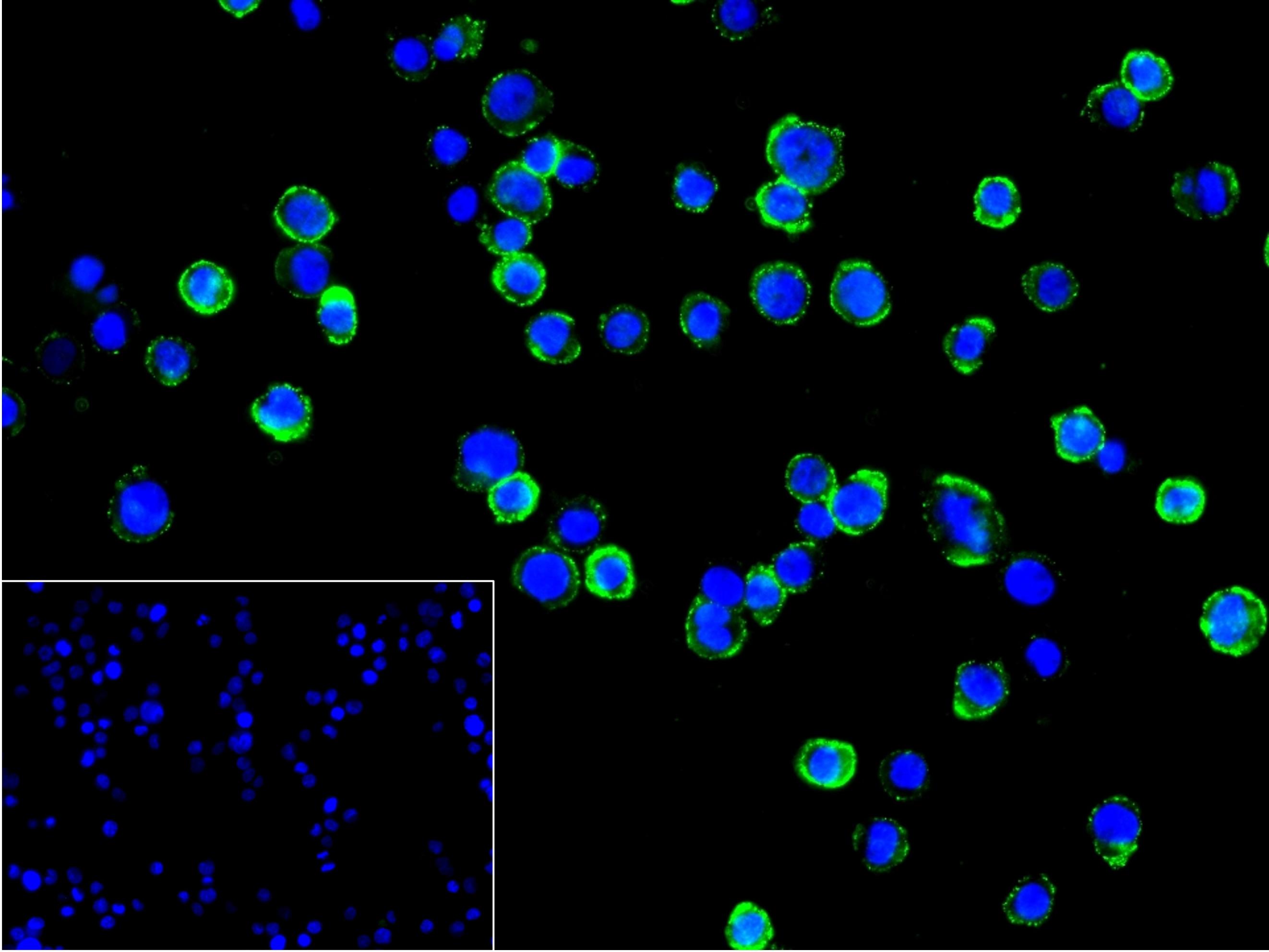B淋巴细胞连接蛋白重组兔单抗