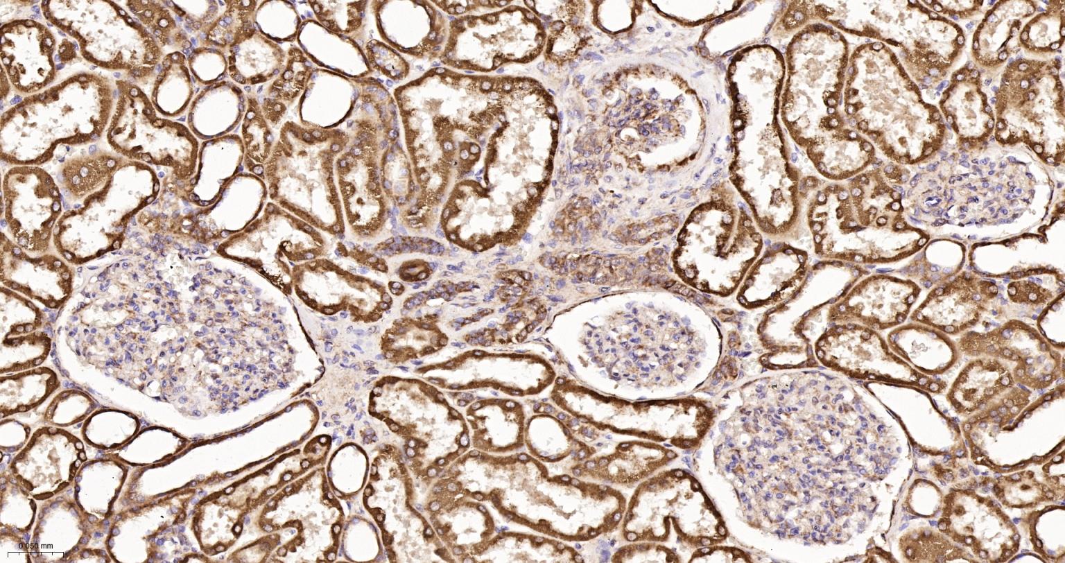 凋亡诱导因子重组兔单抗