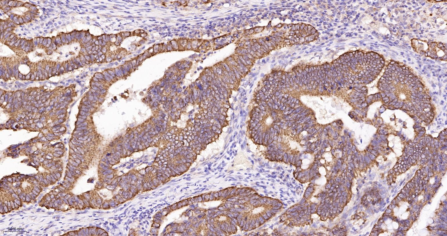 凋亡诱导因子重组兔单抗