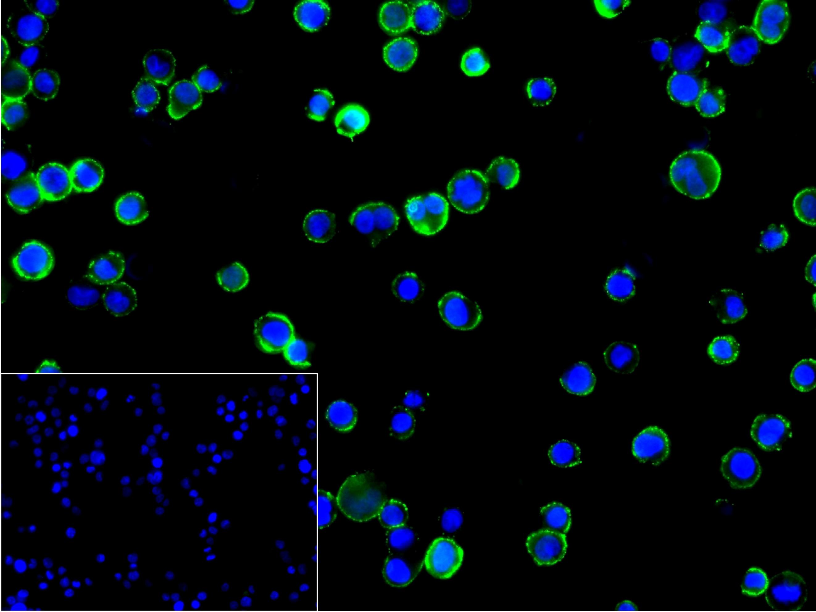 激活素受体相互作用蛋白4重组兔单抗