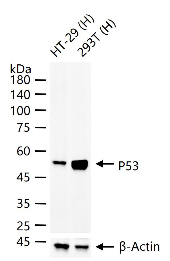 细胞肿瘤抗原P53重组兔单抗