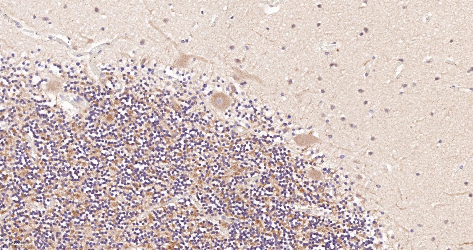 凋亡诱导因子重组兔单抗