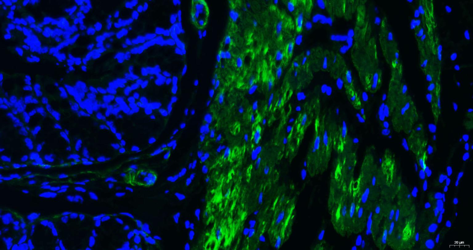 肌动蛋白α/α-SMA/α Actin单克隆抗体-bsm-33188M