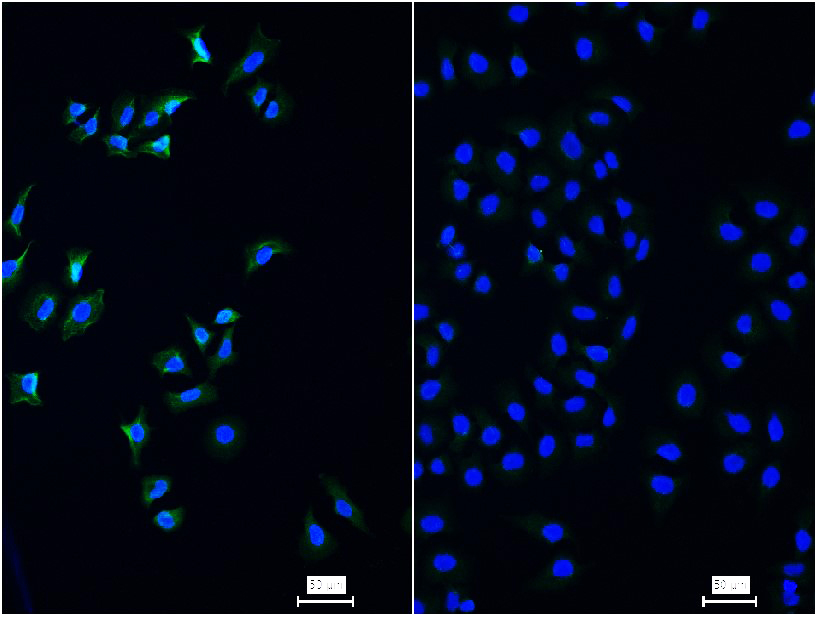 表皮生长因子受体重组兔单抗