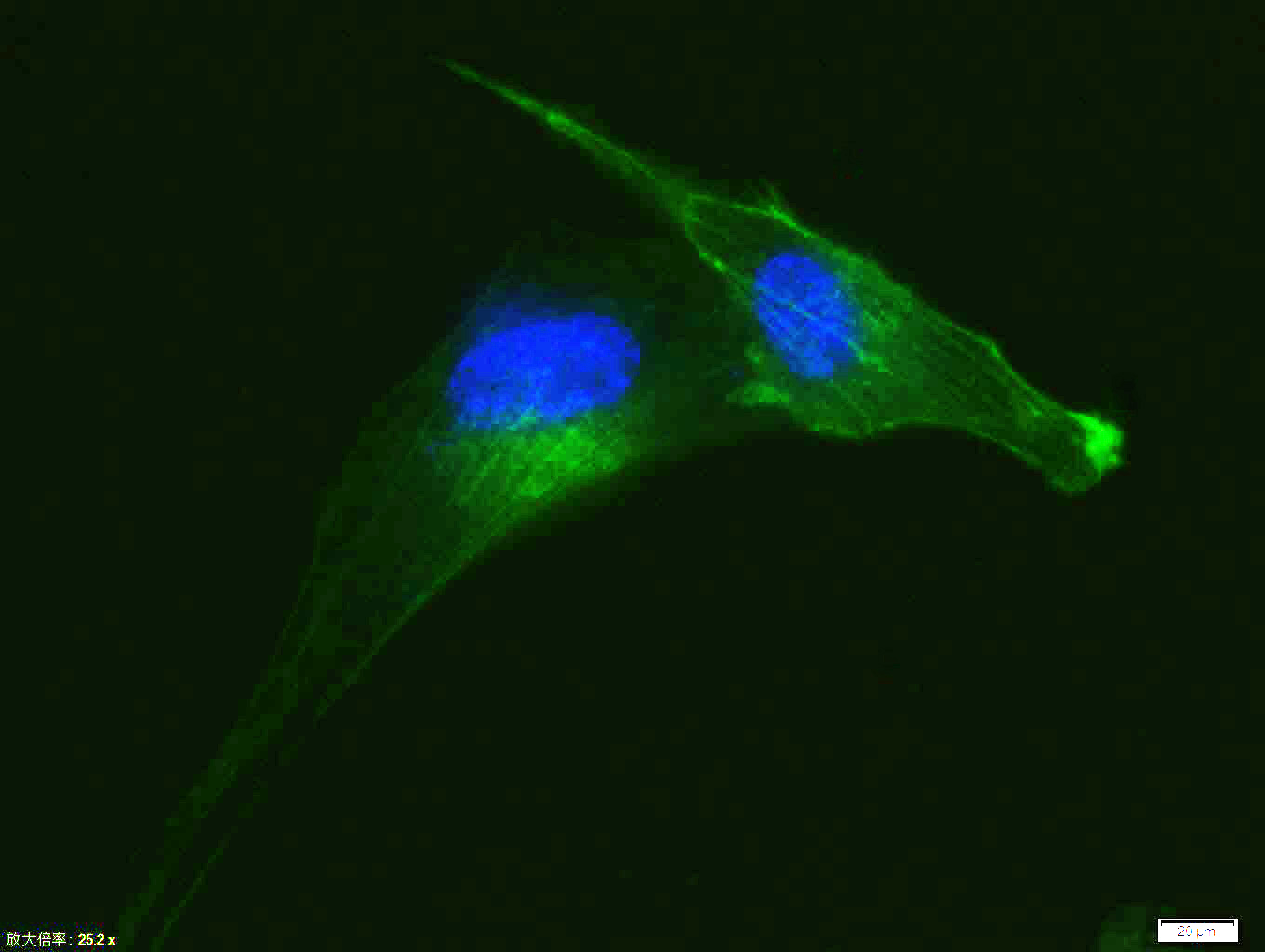α-SMA重组兔单抗