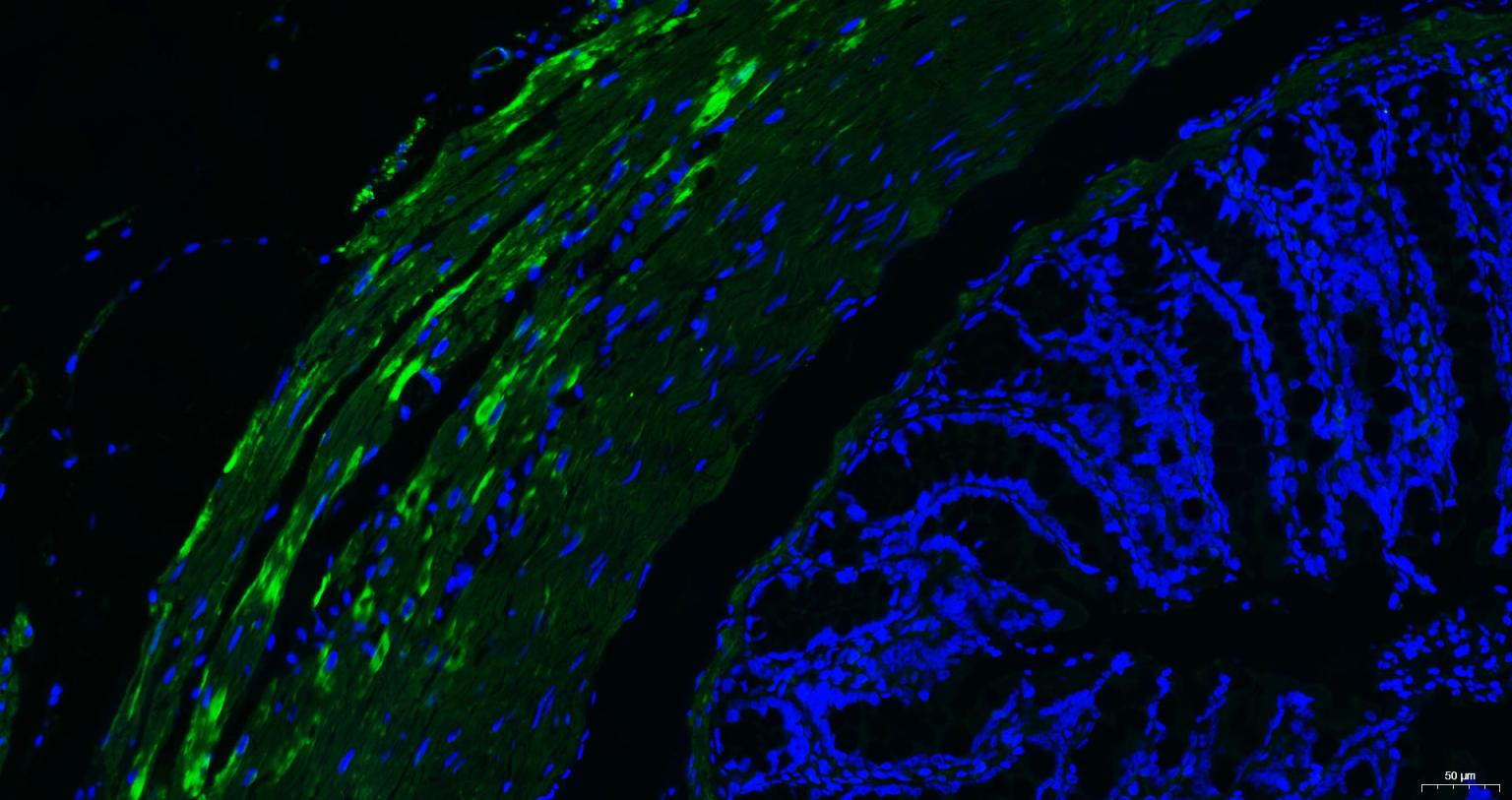 肌动蛋白α/α-SMA/α Actin单克隆抗体-bsm-33188M