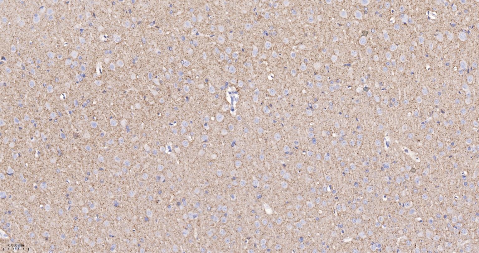 囊泡相关膜蛋白1重组兔单抗-bsm-61962R