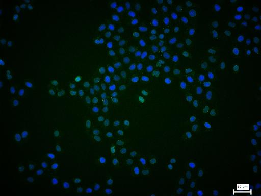 核纤层蛋白A抗体-bsm-34042M