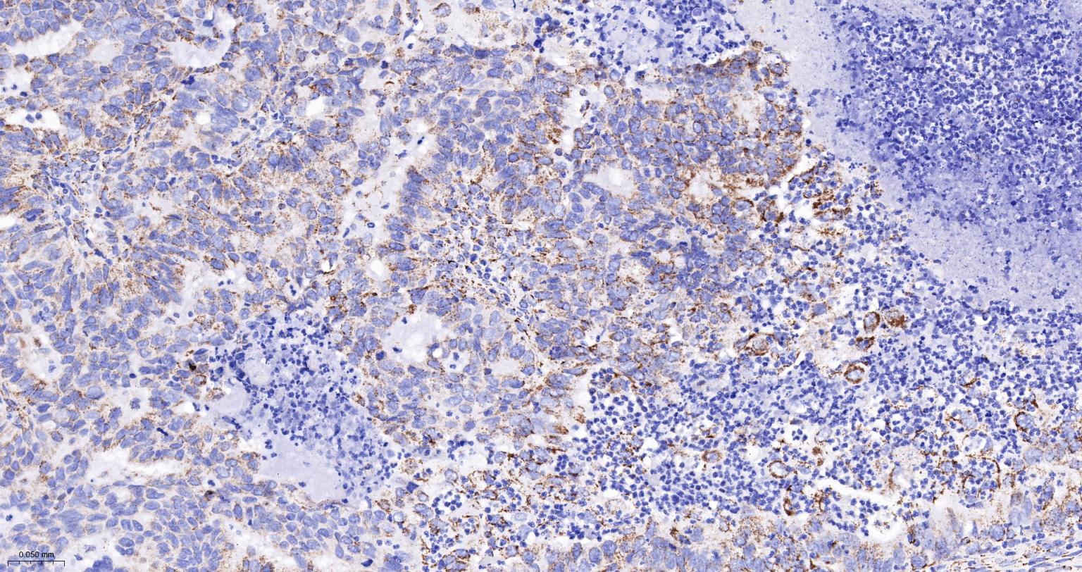 丙酮酸脱氢酶E1β亚单位重组兔单抗